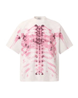 X-Ray Graphic Tee