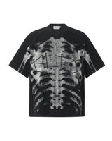 X-Ray Graphic Tee